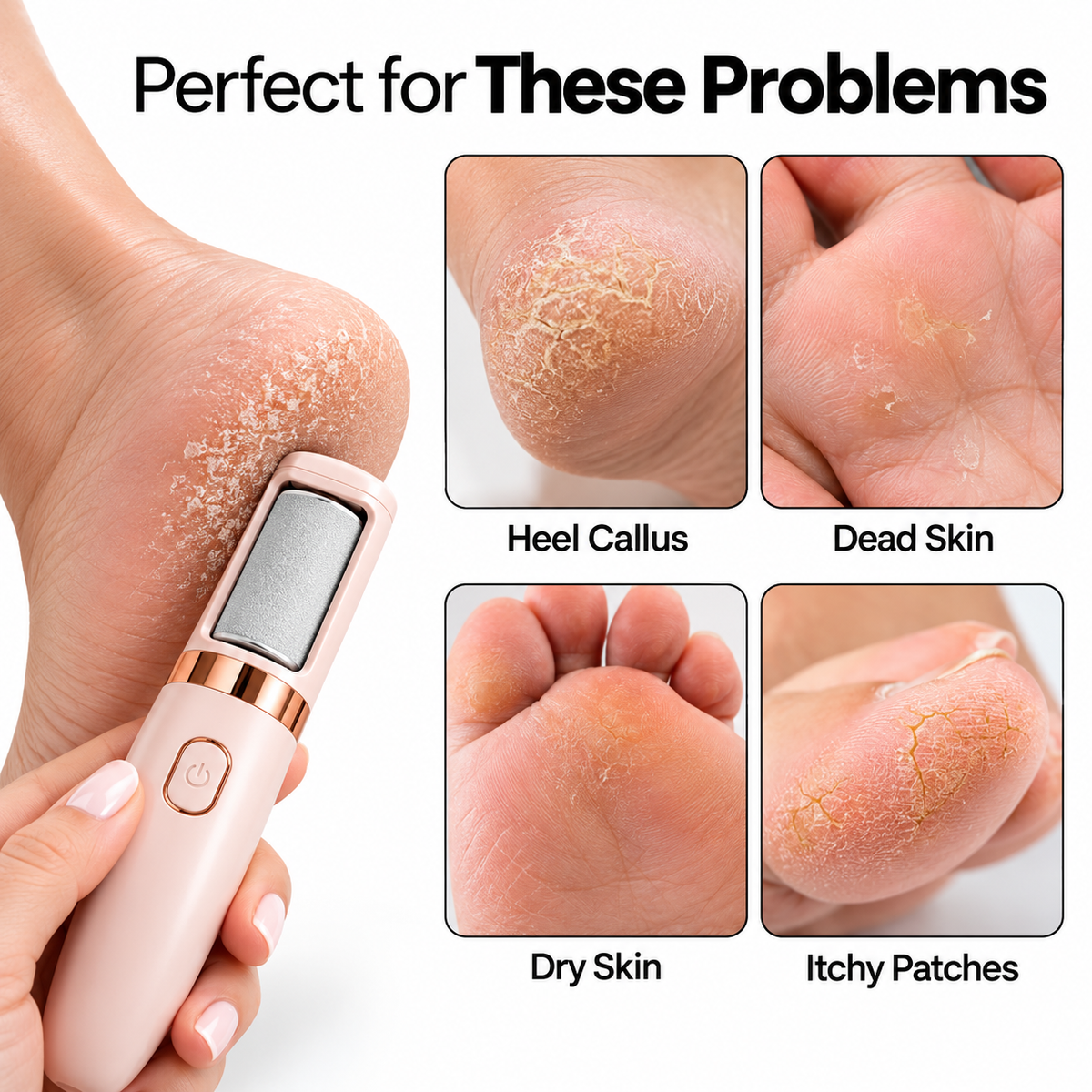 Electric Foot File & Callus Remover